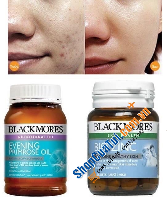 Shopcuatui vn Viên Kẽm tự nhiên Blackmores Bio Zinc 168 viên của Úc