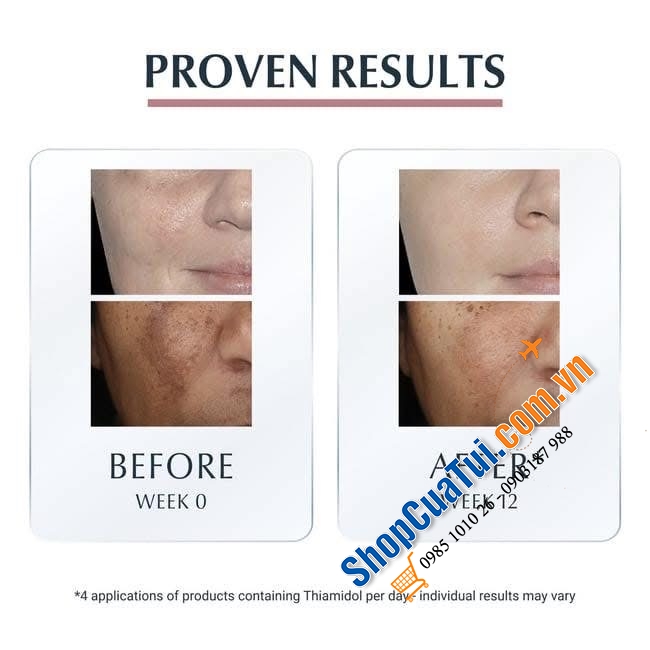 BÚT LÀM MỜ ĐỐM THÂM NÁM EUCERIN.