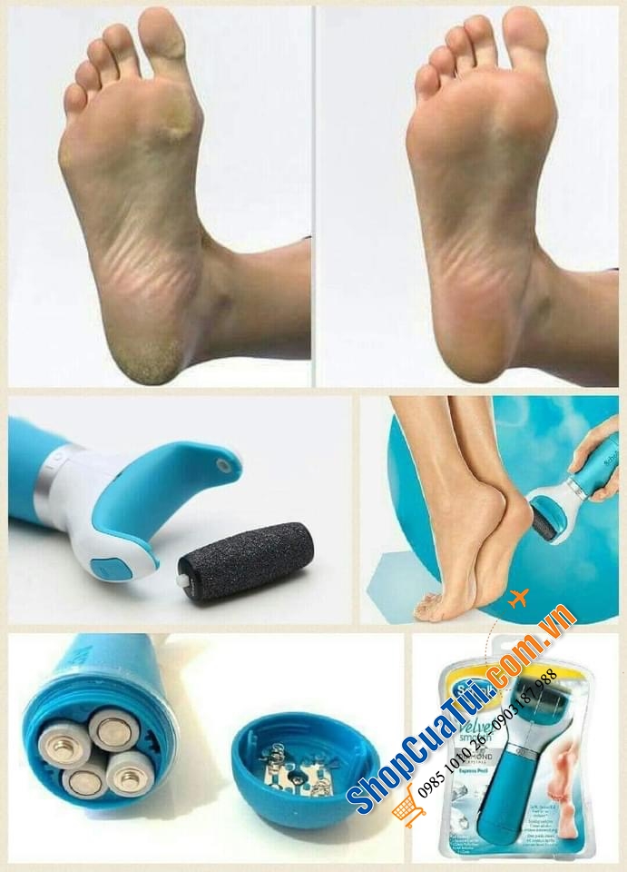 MÁY MÀI DA CHẾT GÓT CHÂN TAY SCHOLL CAO CẤP - dùng pin - Máy chà gót chân SCHOLL VELVET SMOOTH Râpe electrique giúp gót chân mềm mịn, loại bỏ sạch da chết, chai sần...