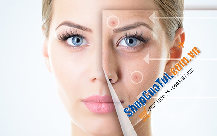 SỮA RỬA MẶT HÀNG TRỊ MỤN NGÀY NEUTROGENA ANTI PICKEL.