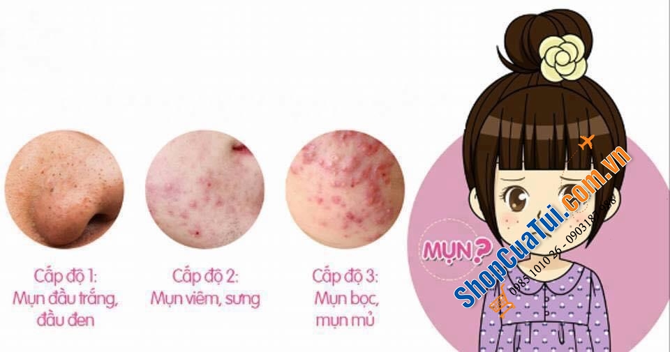 Gel chấm trị mụn tràm trà THURSDAY PLANTATION Tea Tree Medicated Gel For Acne 25 g