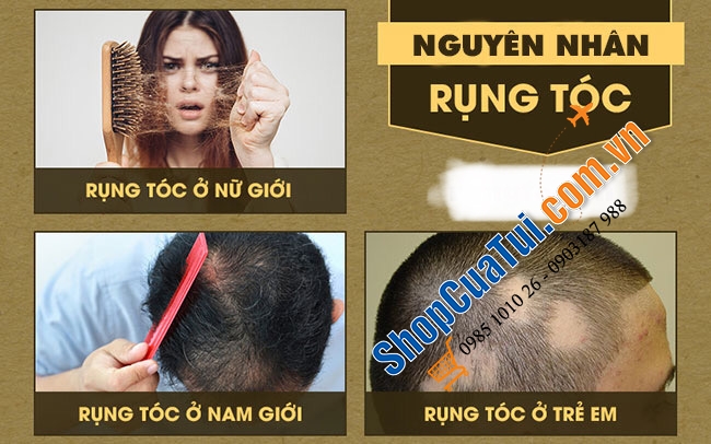 Dầu gội đầu trị rụng tóc, hói đầu làm dầy và dài tóc Priorin của ĐỨC.