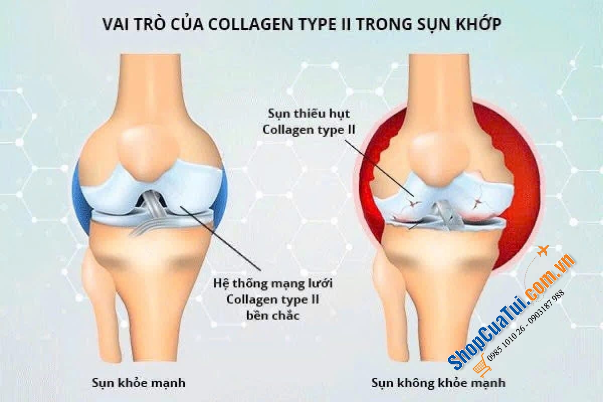KOLLAGEN 11.000 PLUS DOPPELHERZ XƯƠNG KHỚP, COLLAGEN THUỶ PHÂN DẠNG NƯỚC HẤP THU TỐI ƯU VÀO CƠ THỂ