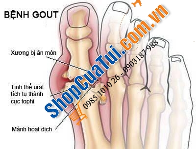 Viên uống phòng và điều trị gút Gout Blackmores Celery 3000 50 Tablets