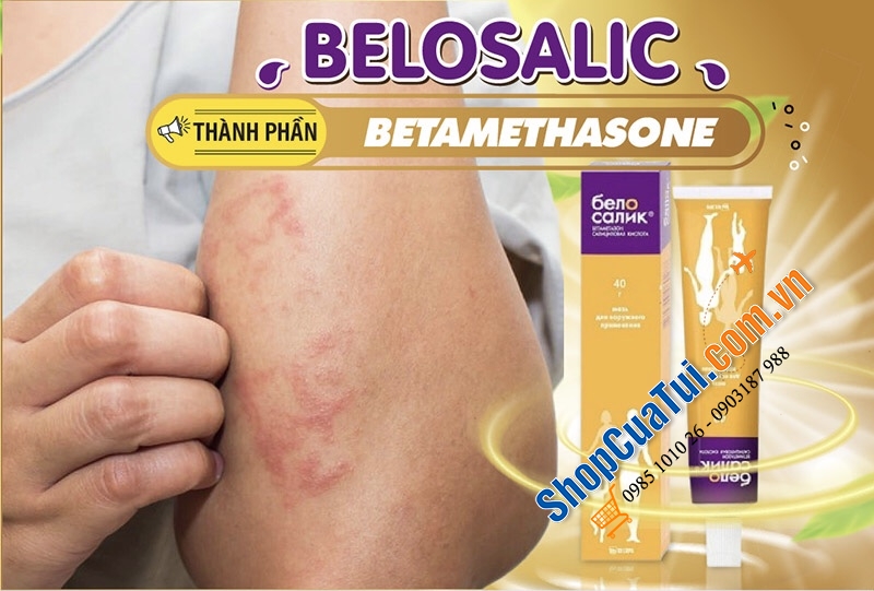 Kem Điều Trị Viêm Da Cơ Địa Belosalic của Nga - Hỗ Trợ Điều Trị Viêm Da Cơ Địa, Vảy Nến, Cải Thiện Vết Thương Bong Tróc,  Chàm Trẻ Em, Mề Đay, Dị ứng, viêm nang lông,...loại vàng dành cho trẻ trên 14 tuổi và người lớn