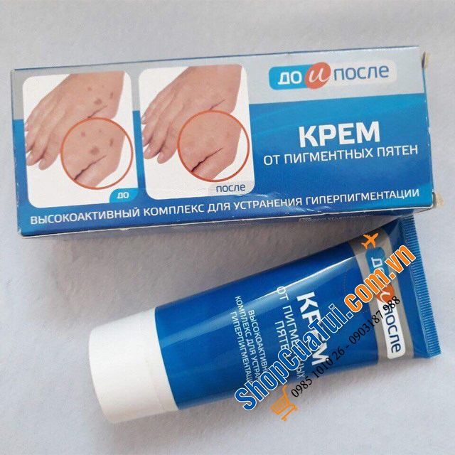 Kem trị đồi mồi, sạm nám, tàn nhang, dưỡng da Kpem của Nga - 100ml