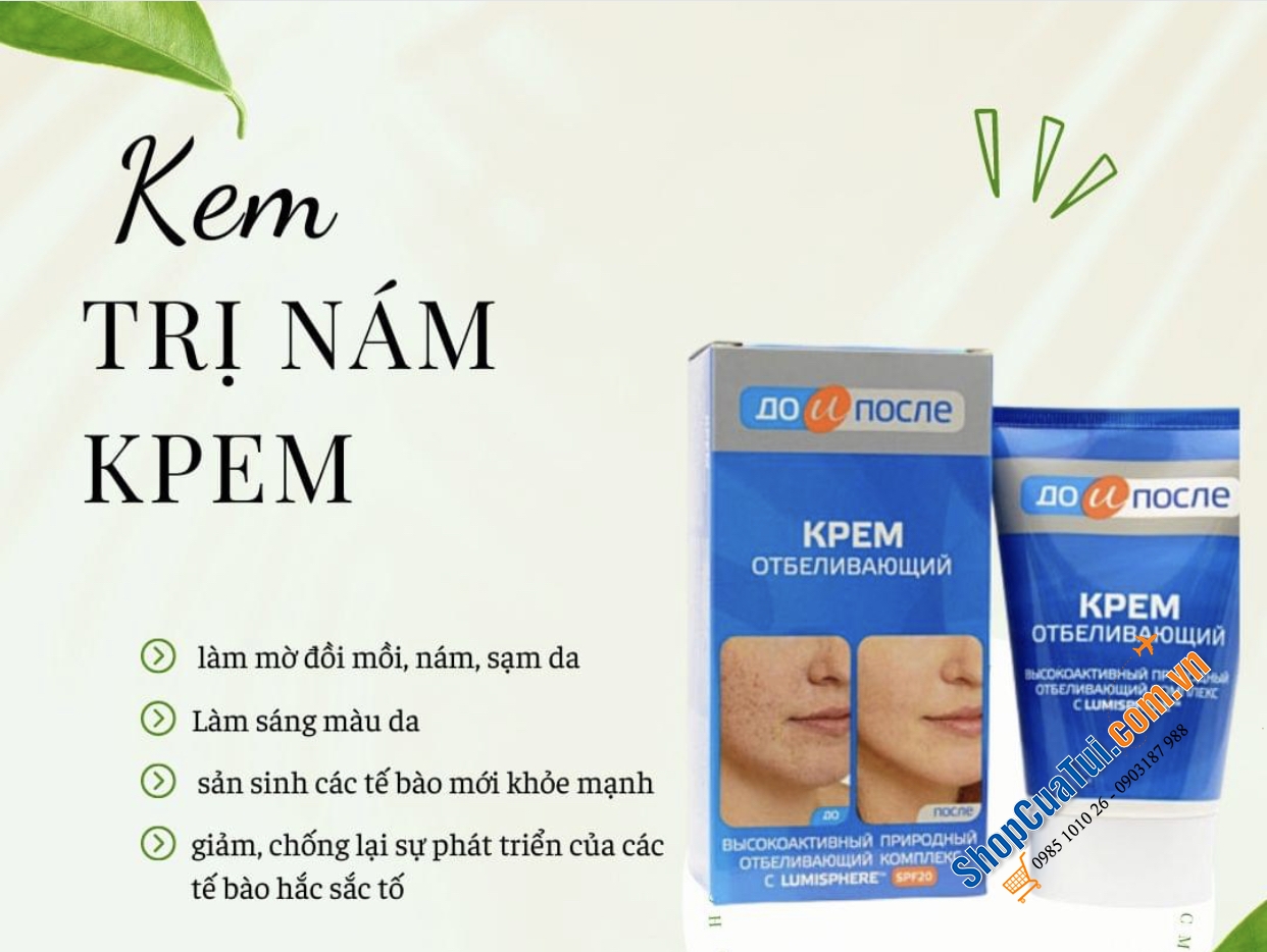 KEM ĐẶC TRỊ NÁM - TÀN NHAN - LÀM TRẮNG DA KPEM CỦA NGA 100ML