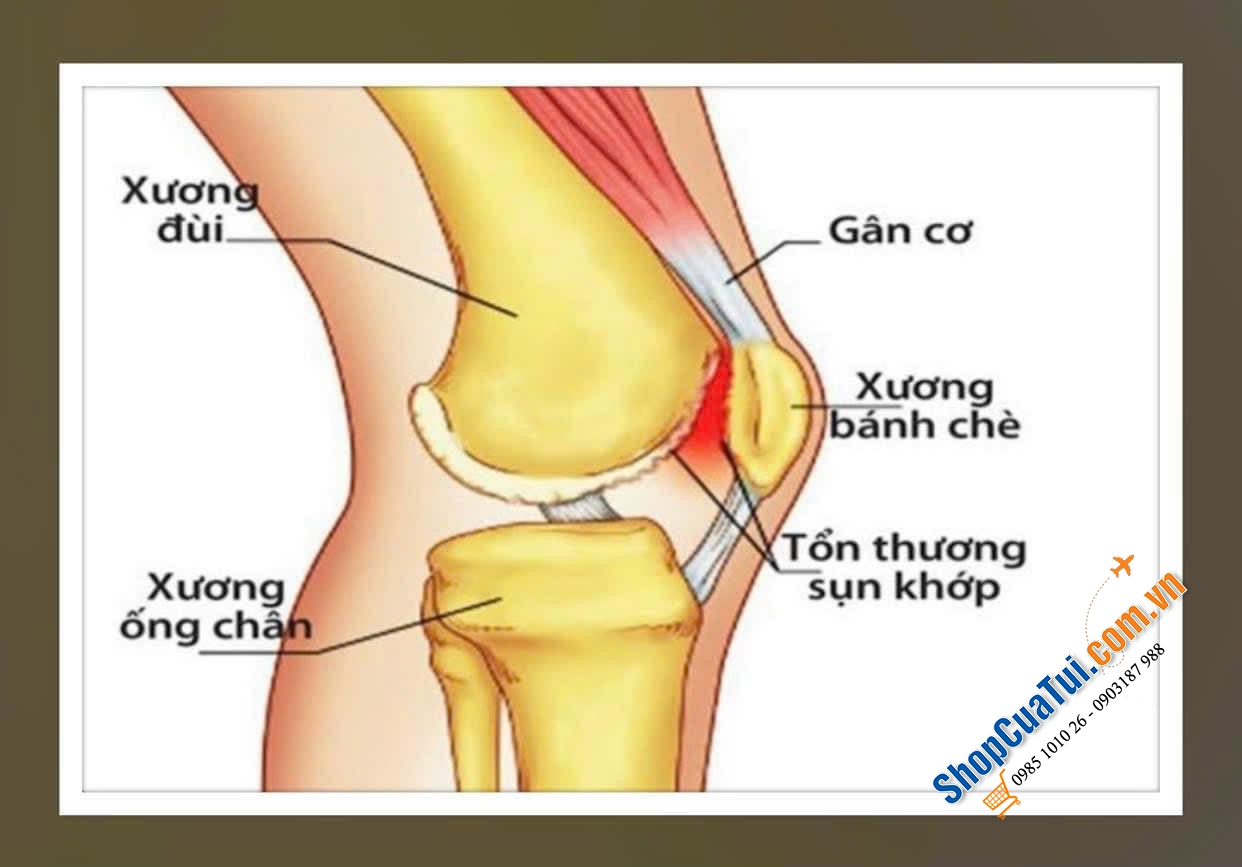 VIÊN UỐNG BỔ SỤN XƯƠNG KHỚP GLUCOSAMIN 500mg CHONDROITIN 400mg, của VELAG Pharma GmbH lọ 270 viên
