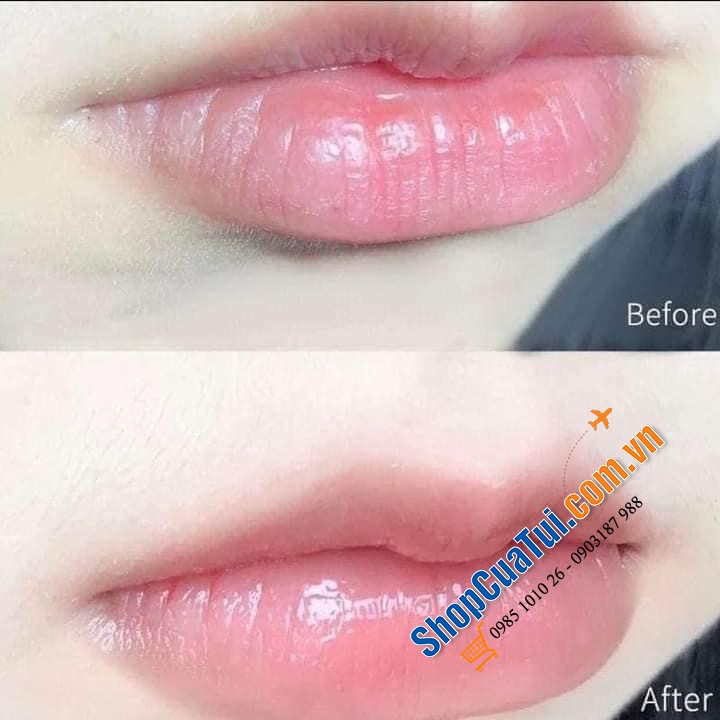 DƯỠNG MÔI VASELINE HUYỀN THOẠI 7 gram  - kem nẻ bản Châu Âu nha!